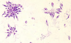 Leishmania donovani